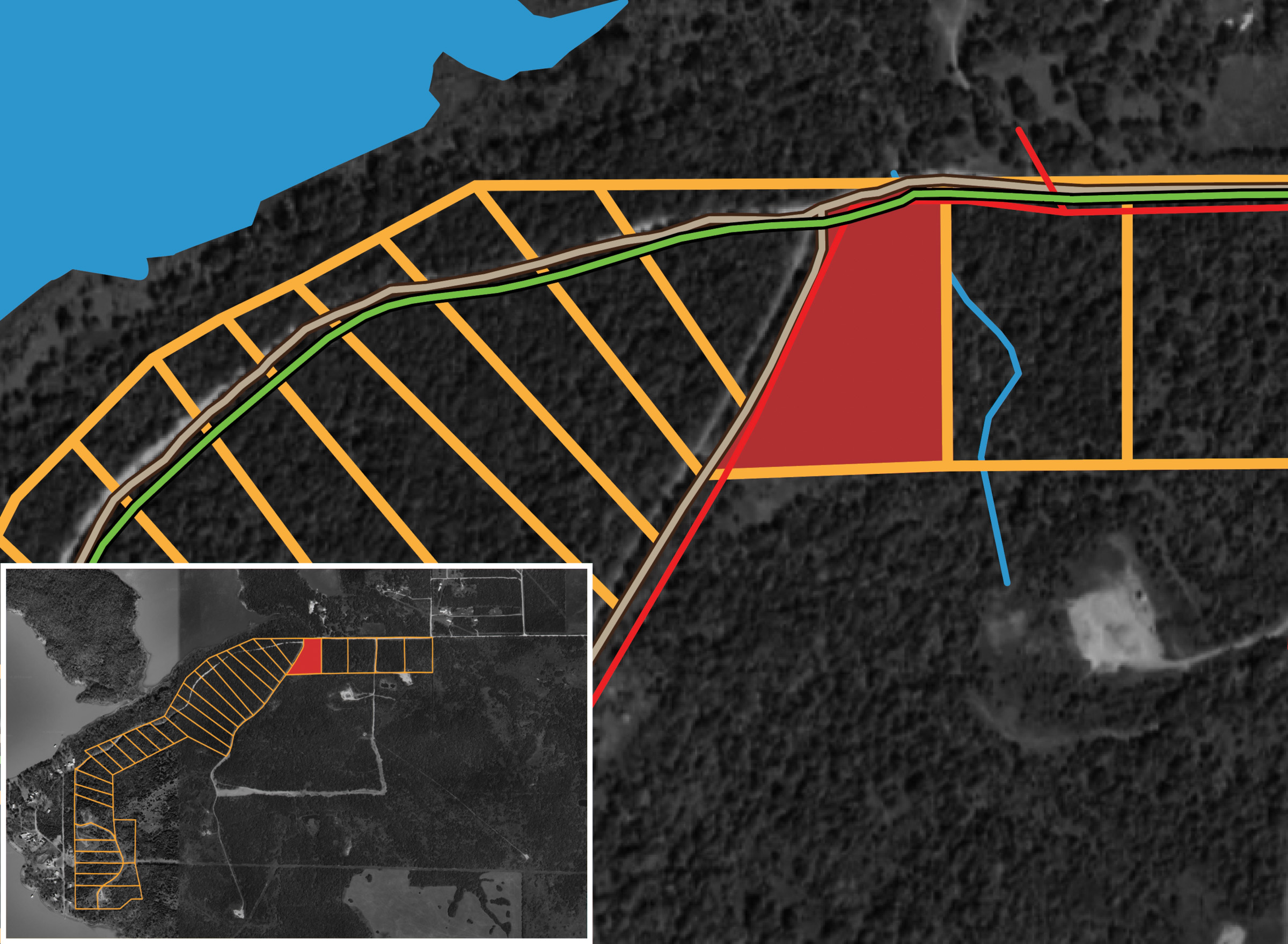 RCCPI-T5 tract image